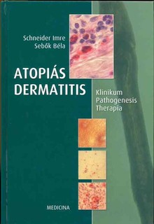 Atopiás dermatitis (Klinikum - Pathogenesis - Therapia)